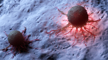 3d rendered illustration of a human cancer cell