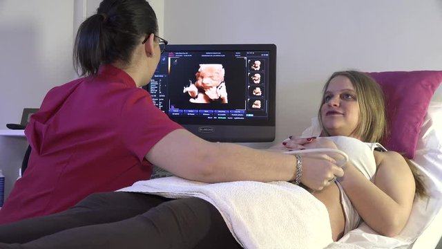 ECOGRAPHY OF A PREGNANT MOTHER