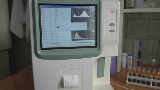 Medical Laboratory - Lab Assistent - Bood Test. HD