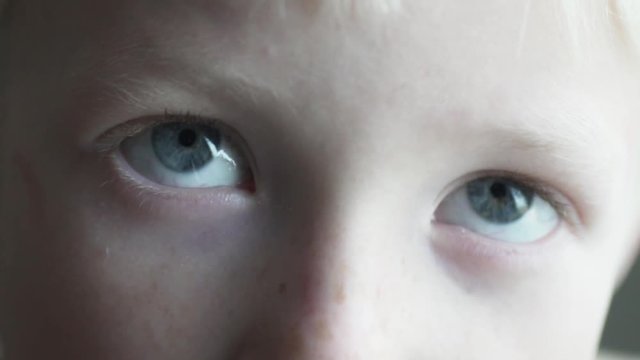 Macro shooting. Eyes of an albino (blond) boy close-up. Two eyes, white eyebrows and white eyelashes. Boy looking at camera. Boy blinks