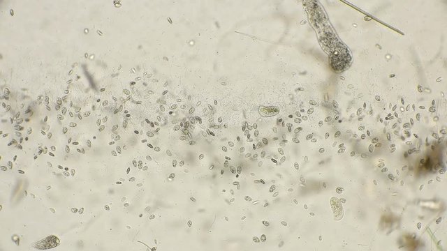 a large colony of microorganisms living in dirty and rotting water: ciliates, bacteria, spirochetes, under a microscope