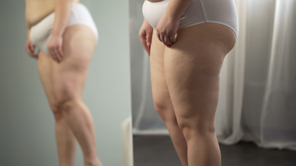 Fat lady hips reflecting in mirror, cellulite and stretch marks on skin, obesity