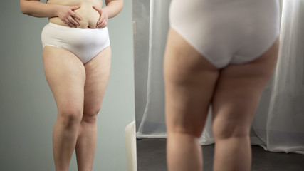 Obese lady looking in mirror, cellulite and stretch marks on hips and big belly
