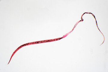 whipworm (Trichuris trichiura) is parasitic helminthic nematode (roundworm)