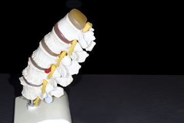 Side view model backbone spinal of five vertebra on black background with space for text