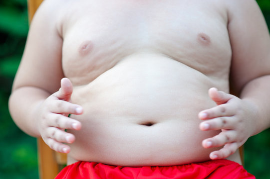 Fat children caused by eating. The boy has grown up. And want to lose weight.