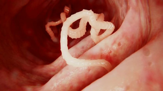 Tapeworm in the intestines, animation