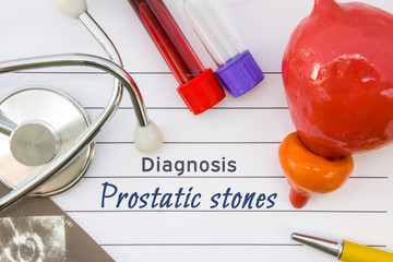 Diagnosis of Prostatic Stones. Figure of prostate is located next to title prostatic stones,...