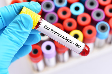 Obraz premium Blood sample tube for zinc protoporphyrin or ZPP test, diagnosis for anemia disease 