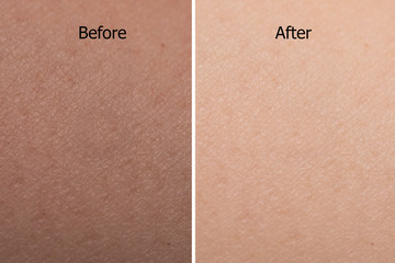 comparison portrait of asian woman skin color texture after using whitening cream