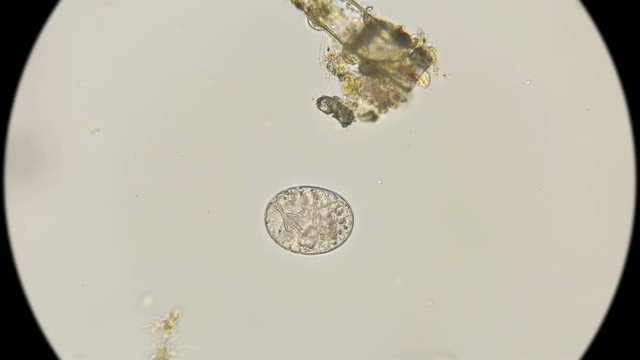 egg with a sambrion of the last stage of a slow-moving Tardigrada under a microscope
