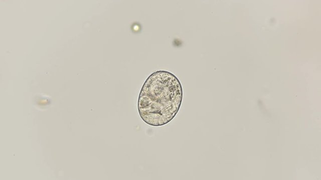 egg with a sambrion of the last stage of a slow-moving Tardigrada under a microscope
