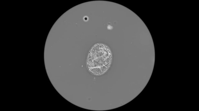 egg with a sambrion of the last stage of a slow-moving Tardigrada under a microscope