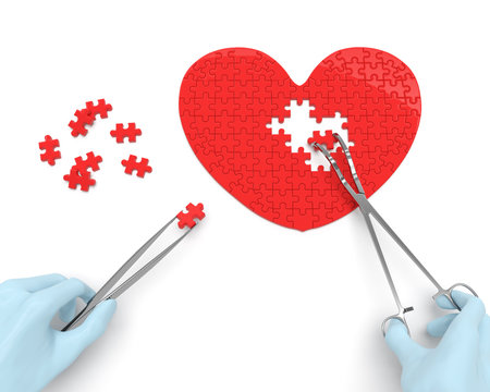 Heart operation puzzle concept: hands of cardiac surgeon with surgical instruments performs heart surgery as a result of myocardial infarction, coronary artery disease, bypass graft, valvular defect