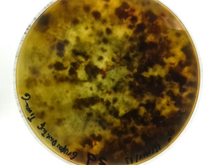 Petri dish with dark brown fungi after growing a mycological sample of molds. Small and circular colonies.