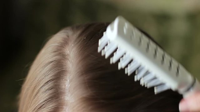 Dandruff and greasy hair on the head of a adult female