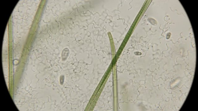 colony of bacteria spirochetes under a microscope