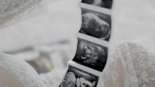 pregnant woman ultrasound photo