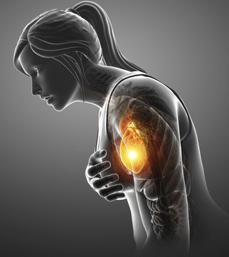 Woman with chest pain, illustration