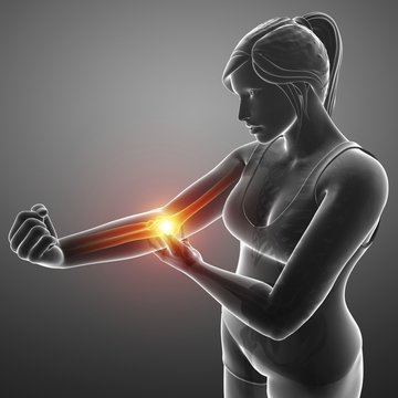 Woman with elbow pain, illustration