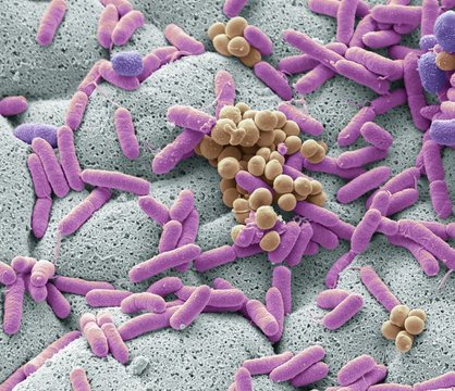 Bacteria found on dishcloth, SEM