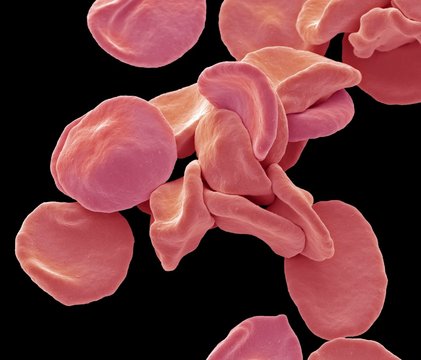 Red blood cells, SEM