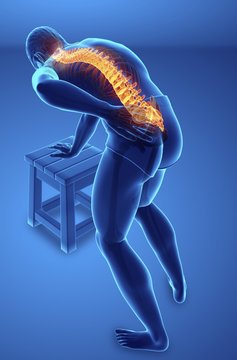 Man with back pain, illustration