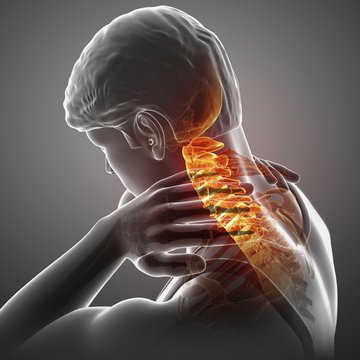 Man with neck pain, illustration