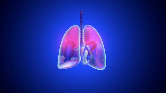 Animation of human lungs inflamed and infected by a disease like Pneumonia or Tuberculosis.
