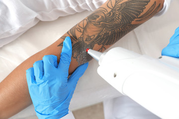 Woman undergoing laser tattoo removal procedure in salon, closeup