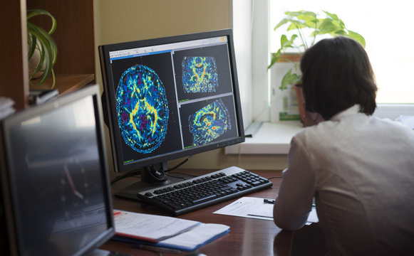 A radiologist is working on a CT scan of a brain tumor