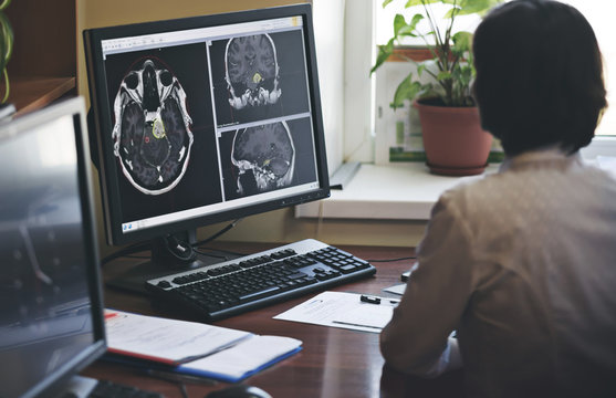 A radiologist is working on a CT scan of a brain tumor