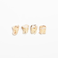pulled out bad molars human teeth close up on white background