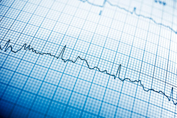 Electrocardiogram close up