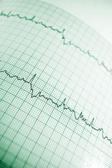 Electrocardiogram close p