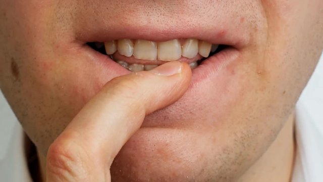 stressed man by teeth gnaws his nail on finger, close up