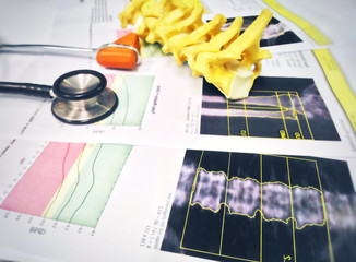 Close up stethoscope knee jerk and spine models Put on a bone Density report.too soft and blurry image.