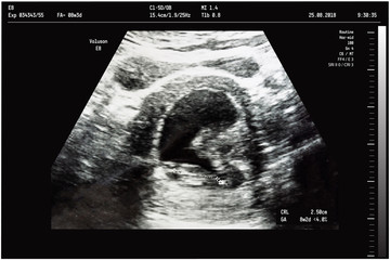 An ultrasound of a mother fetus during the 08th week background as Medical and Health of the baby concept. vector illustration.