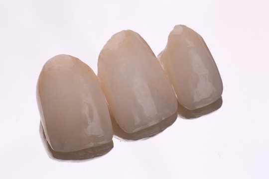dental ceramic veneers and crowns isolated with mirror background.