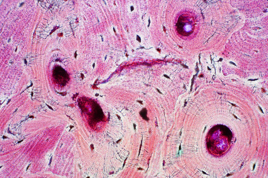 Histology of human compact bone tissue under microscope view for education