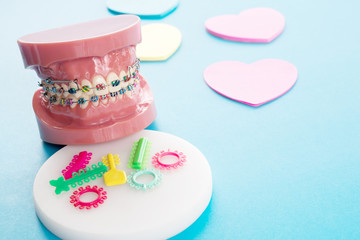 orthodontic model and dentist tool - demonstration teeth model of varities of orthodontic bracket...