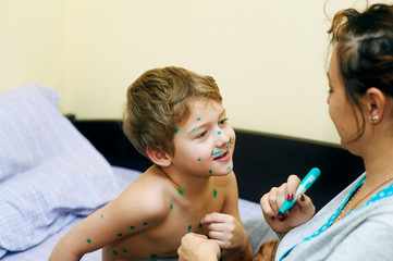 the child has chickenpox . Mother treats sick son