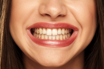 young woman showing her natural and healthy teeth