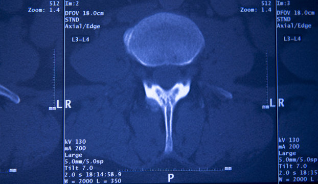 Medical hips spine pelvis MRI scan