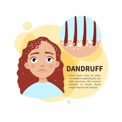 Vector poster. Dandruff. Sad cute girl. Disease of the skin.