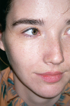 Freckle girl