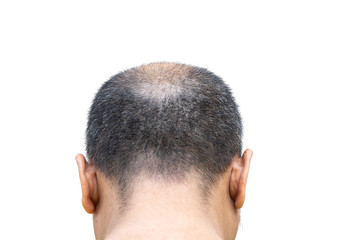 photo short bald man