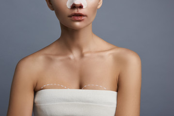 Young lady having bloody nose and lines on her breasts before the breast augmentation