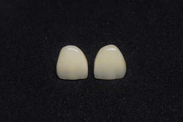 ceramic crown isolate on black background