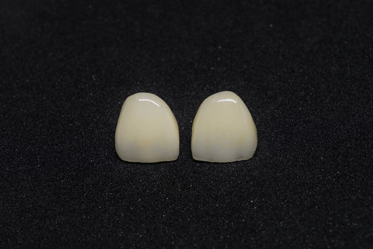 ceramic crown isolate on black background